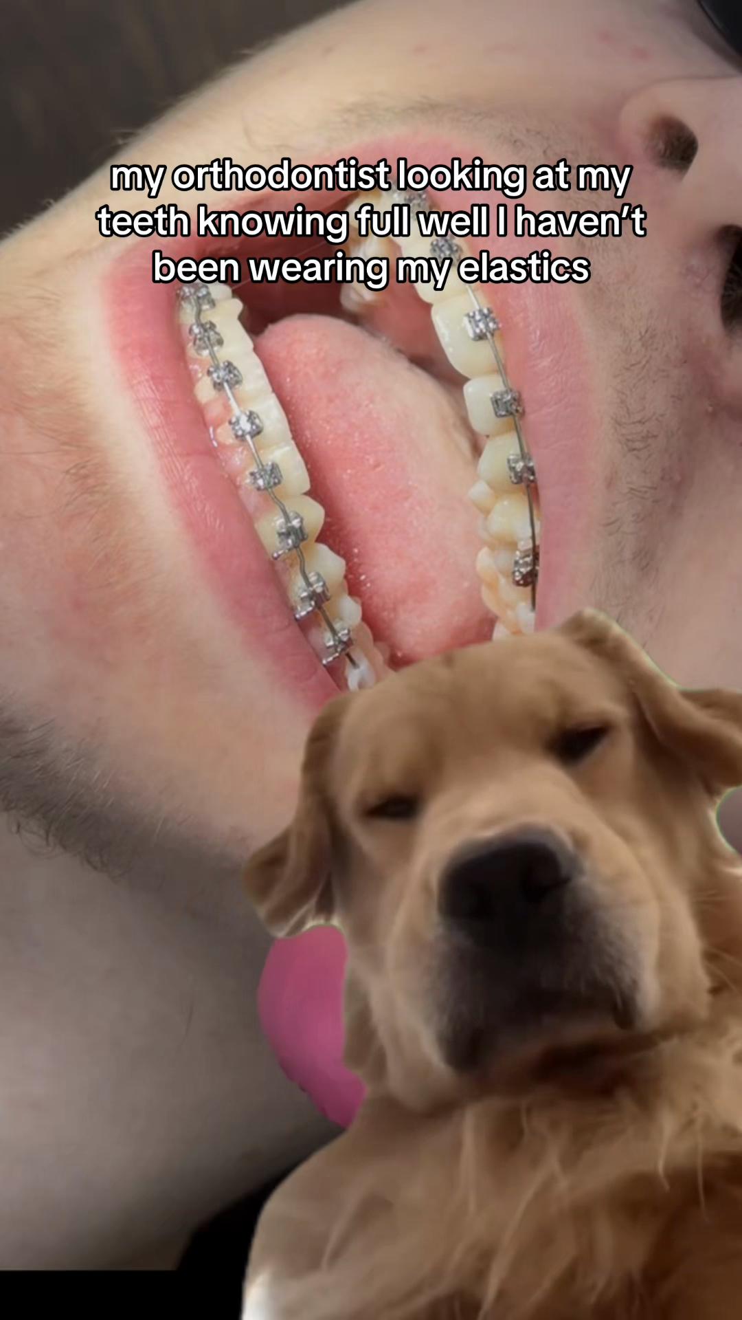 @Pure Orthodontics