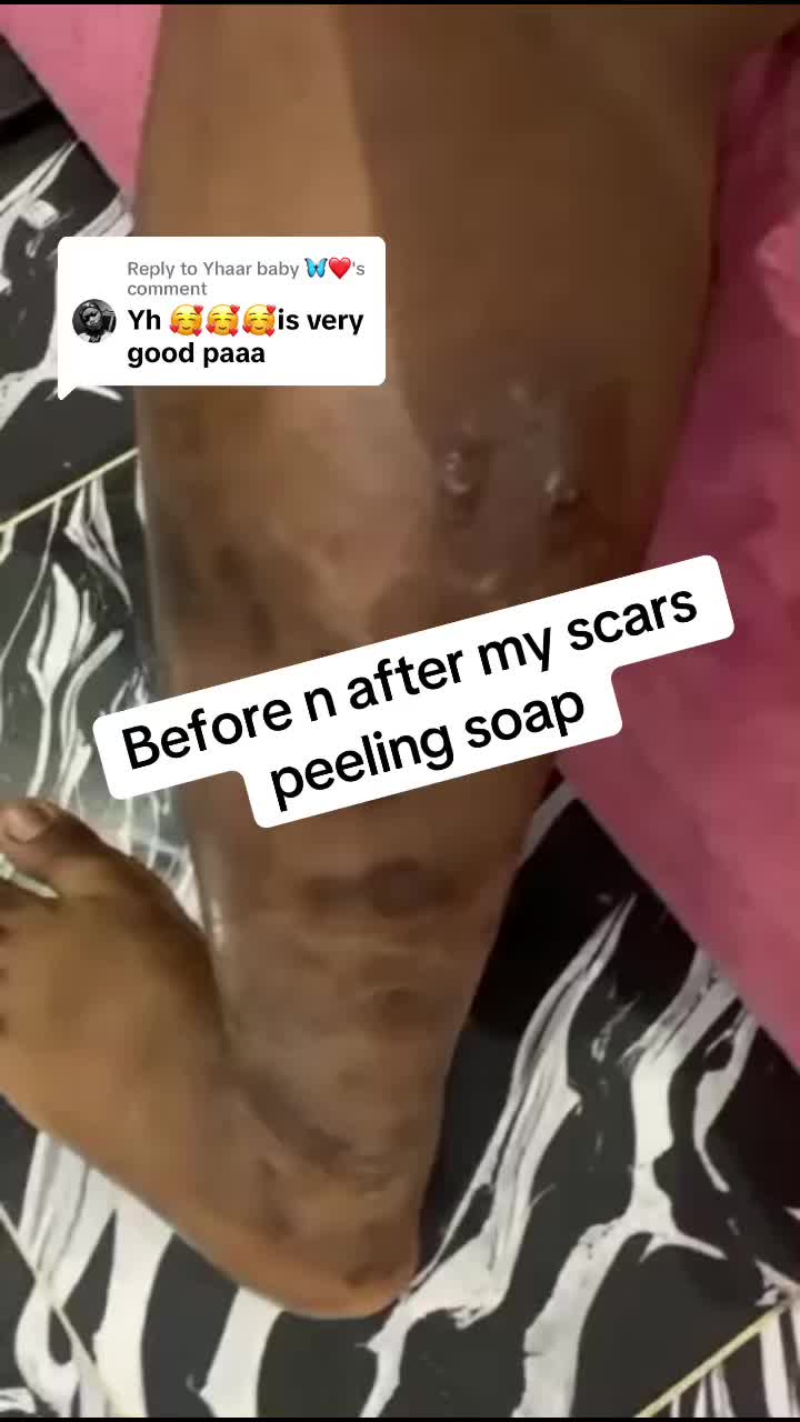@@ Precious peeling soap
