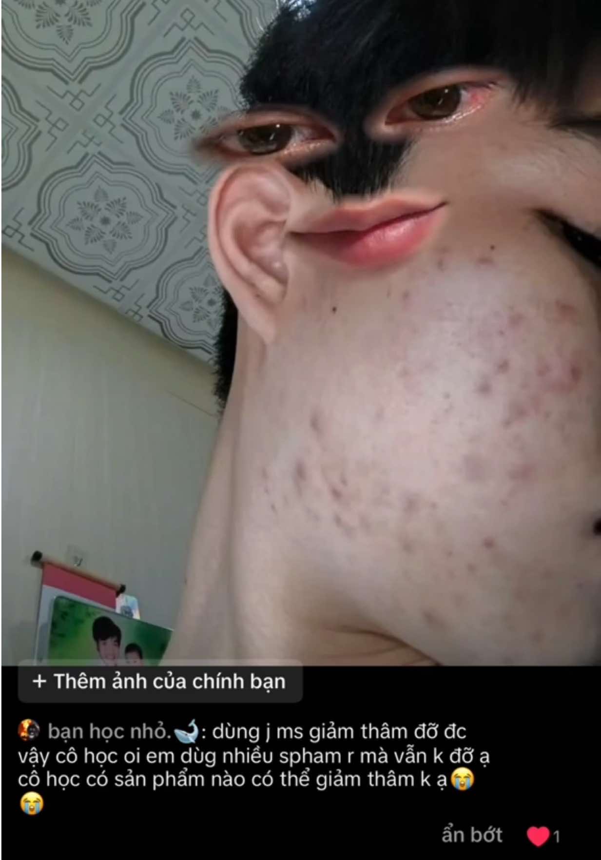 @Cô Học Chăm Da