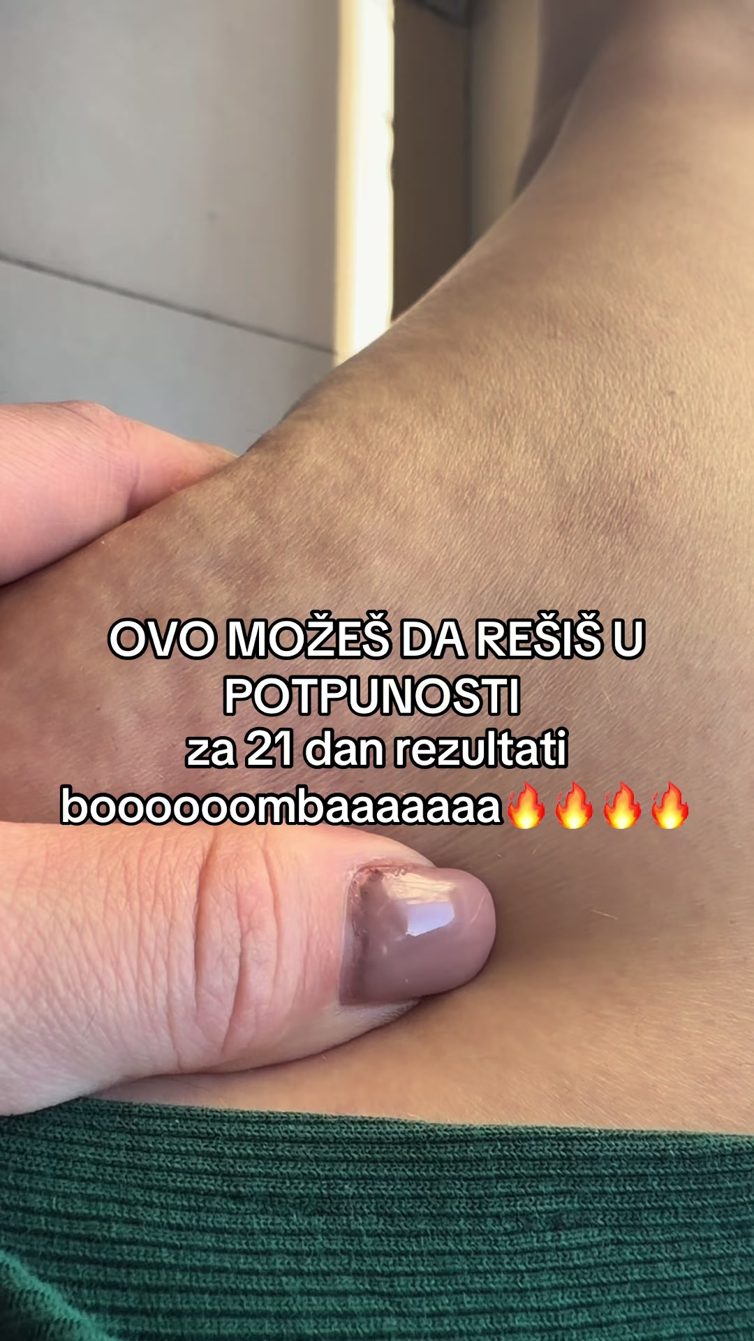 @Re&scaron;i se celulita i kilograma🌼