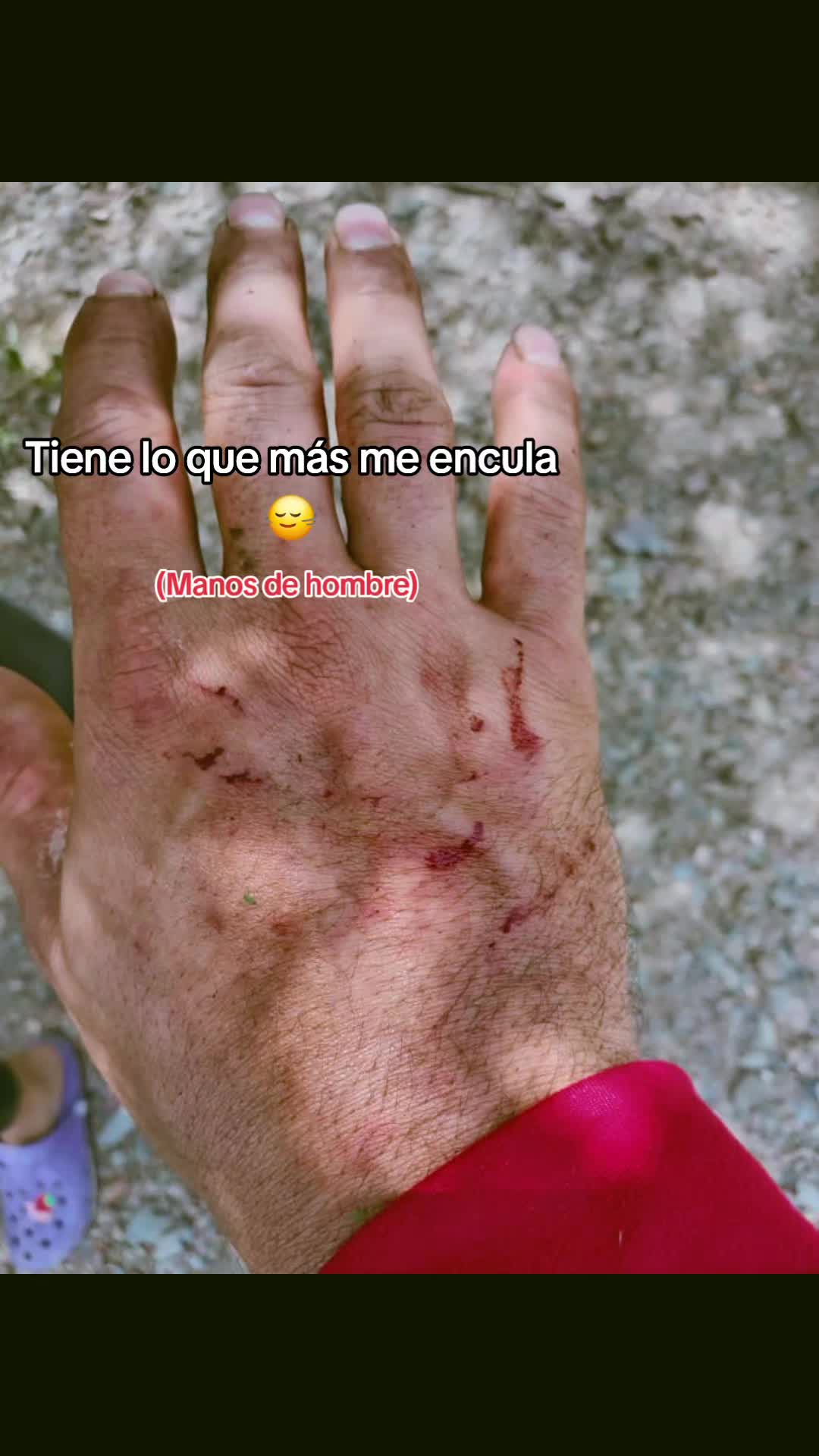 @🧿LaCrespita🇻🇪
