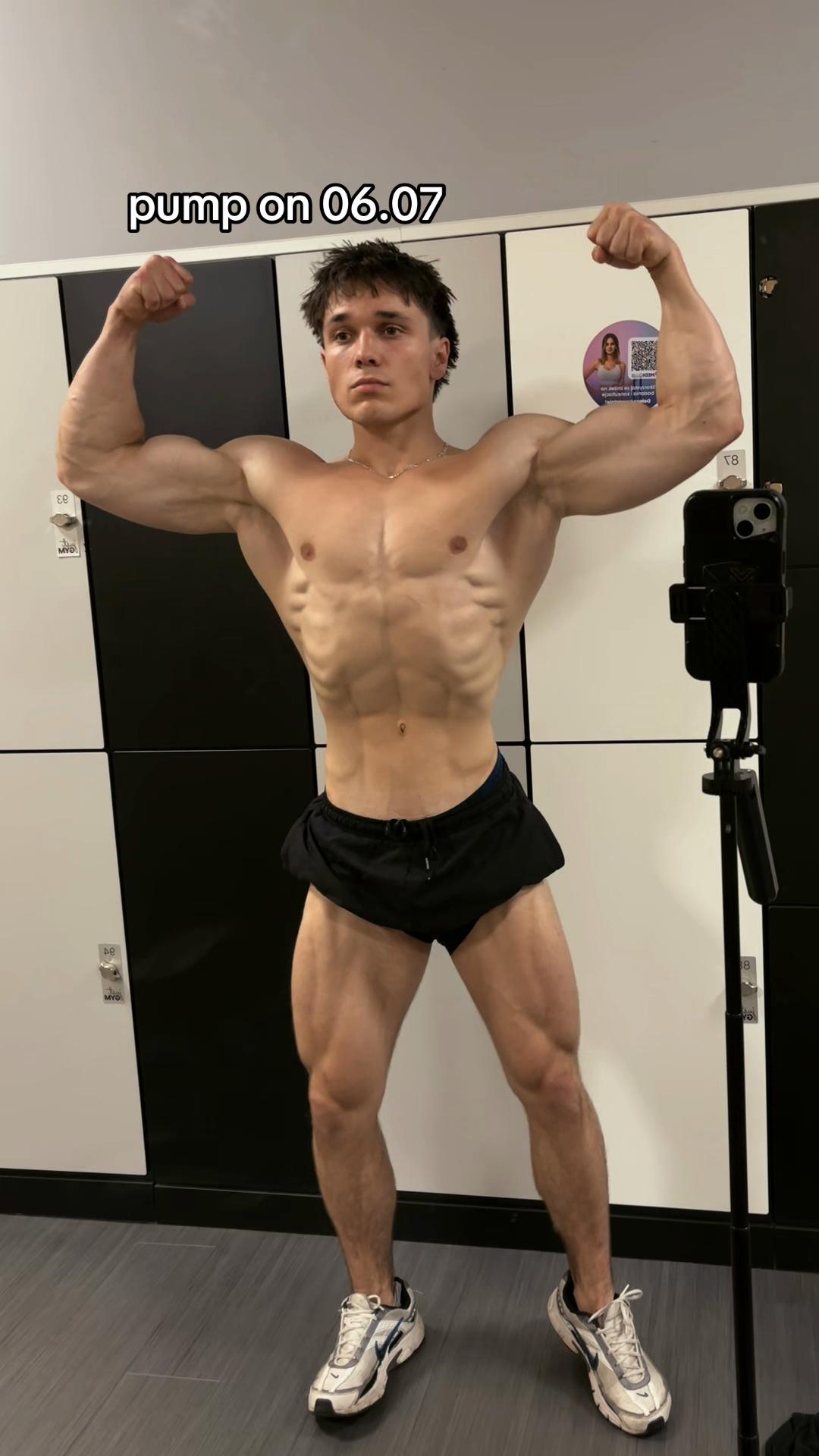 @michaltriceps_13.9cm