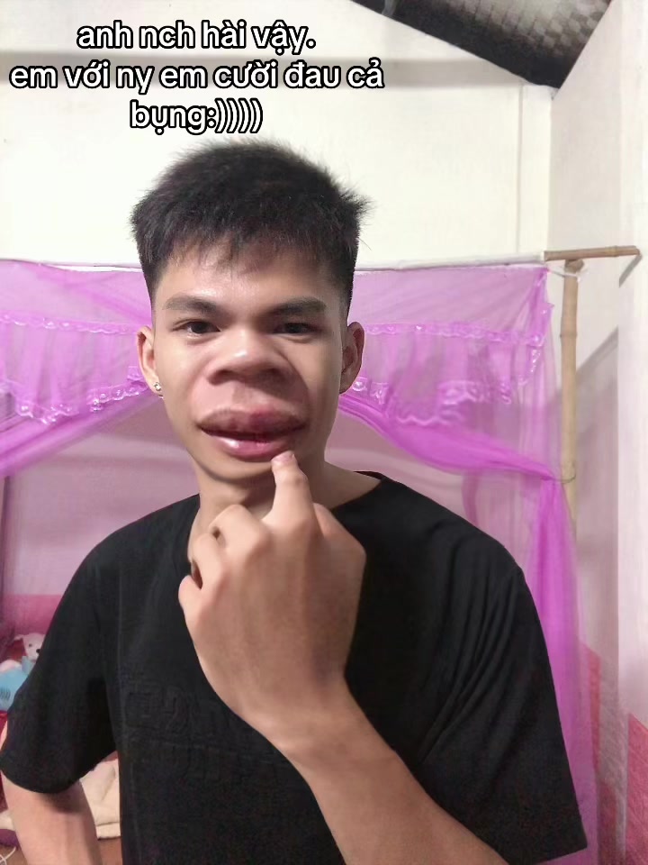 @๐ฝ๐ป๐๐๐ฬ(nanh).