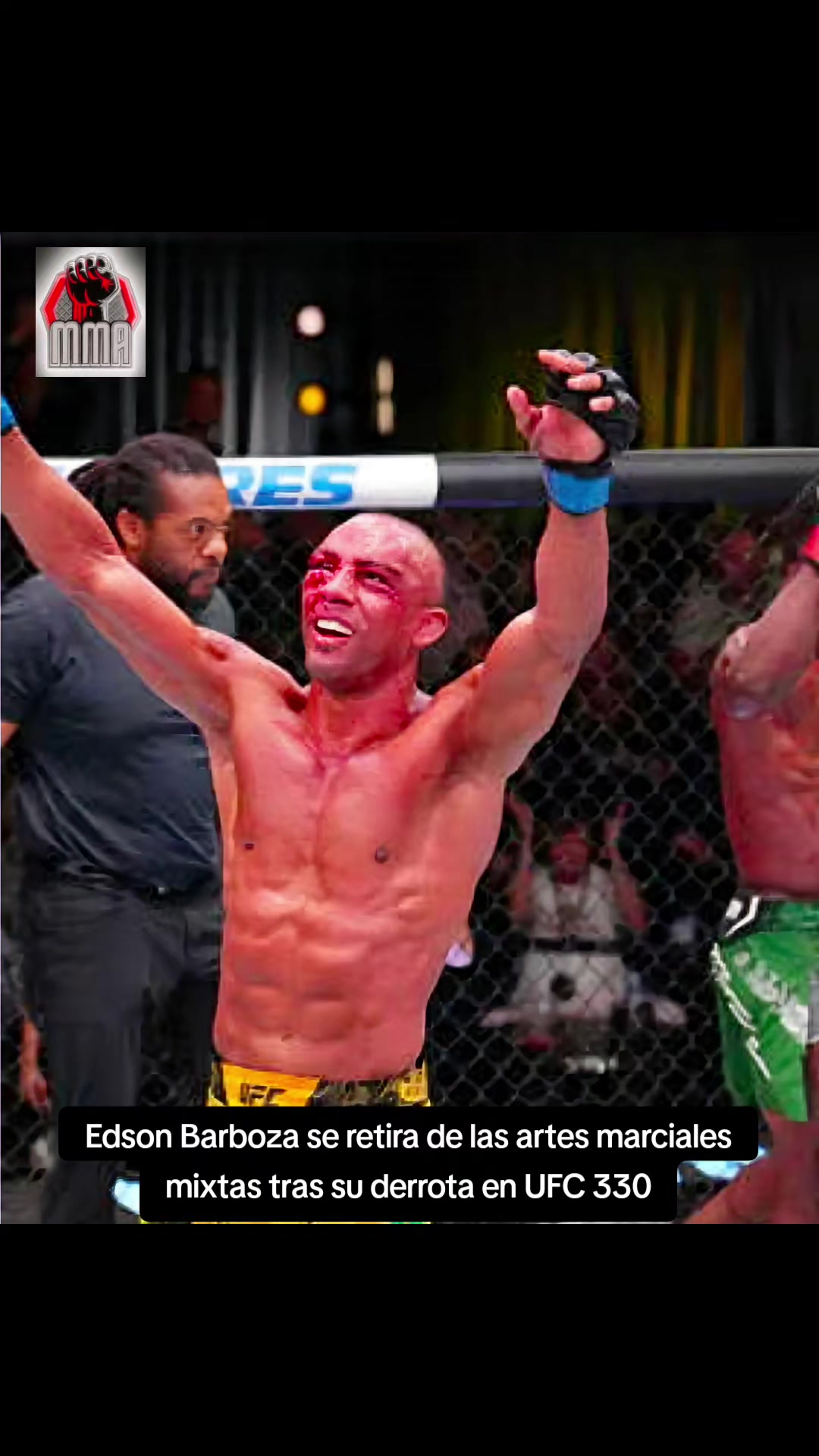 @GLOBALMMA