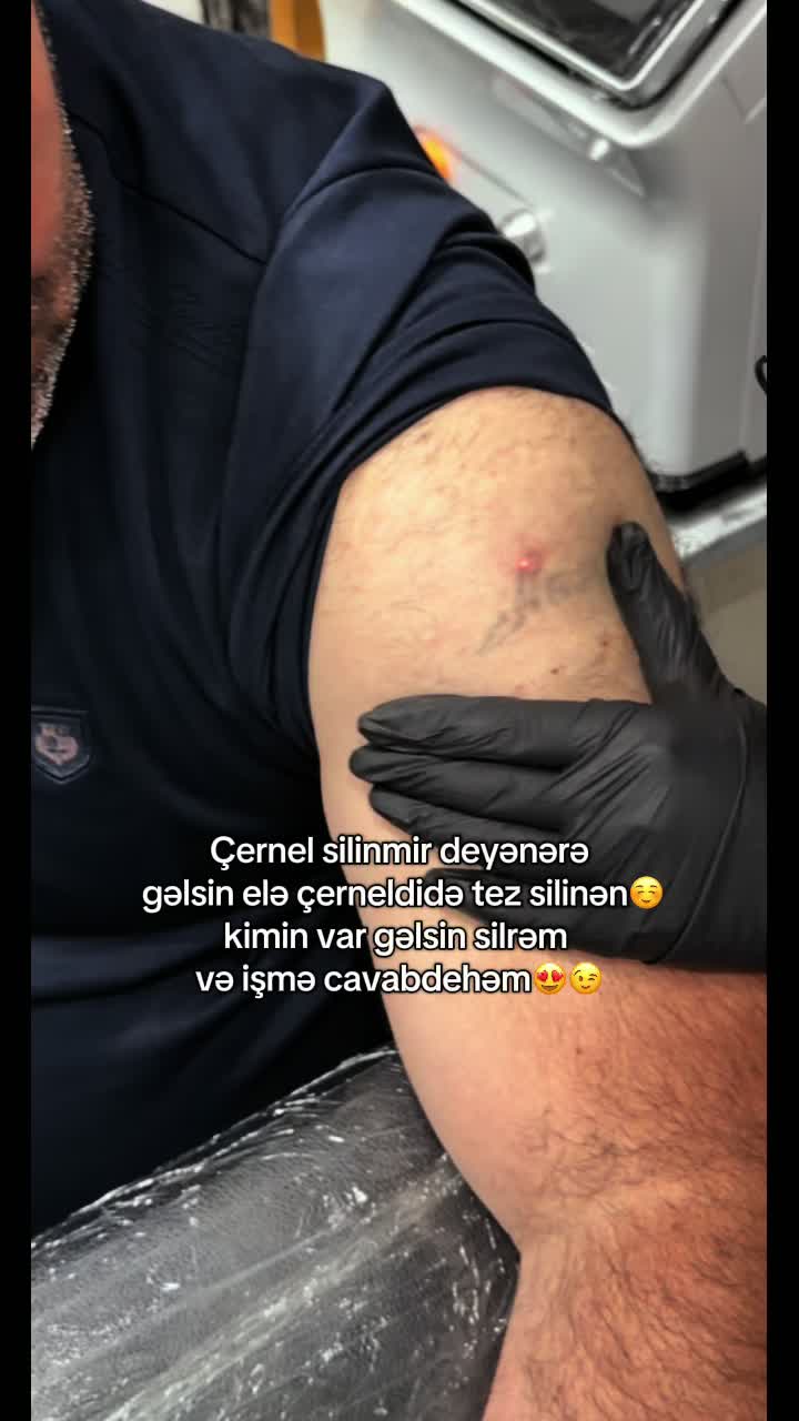 @TattooAysel