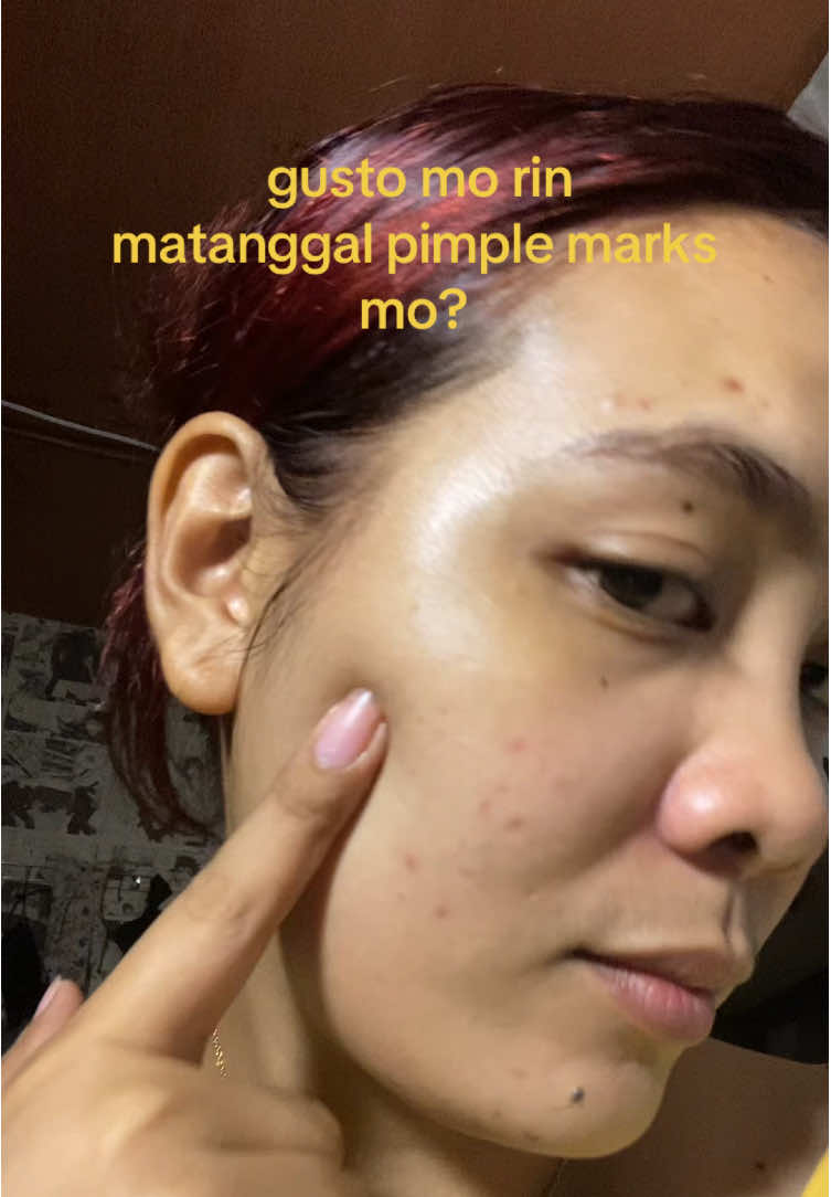 @hae