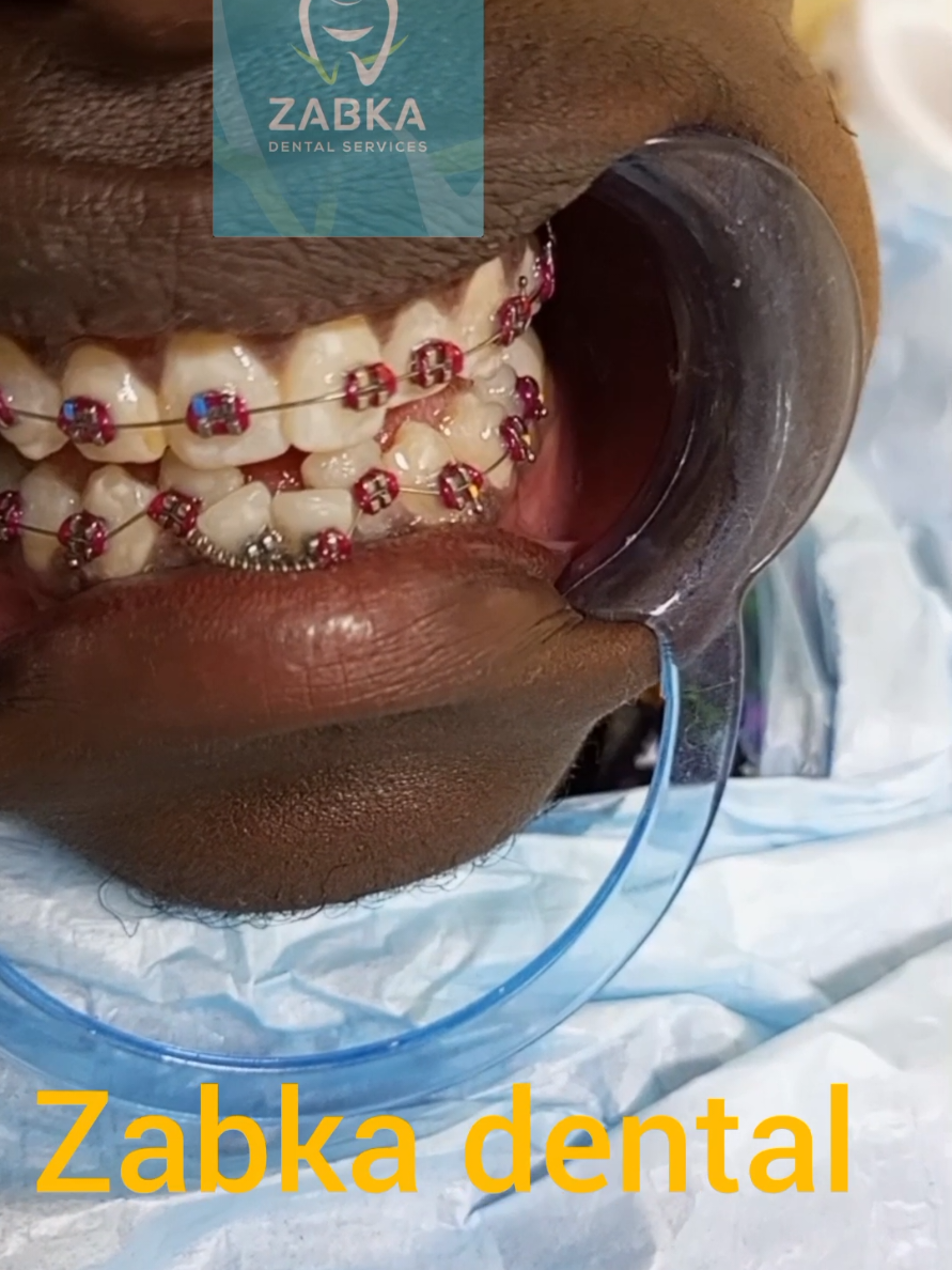 @Zabka Dental