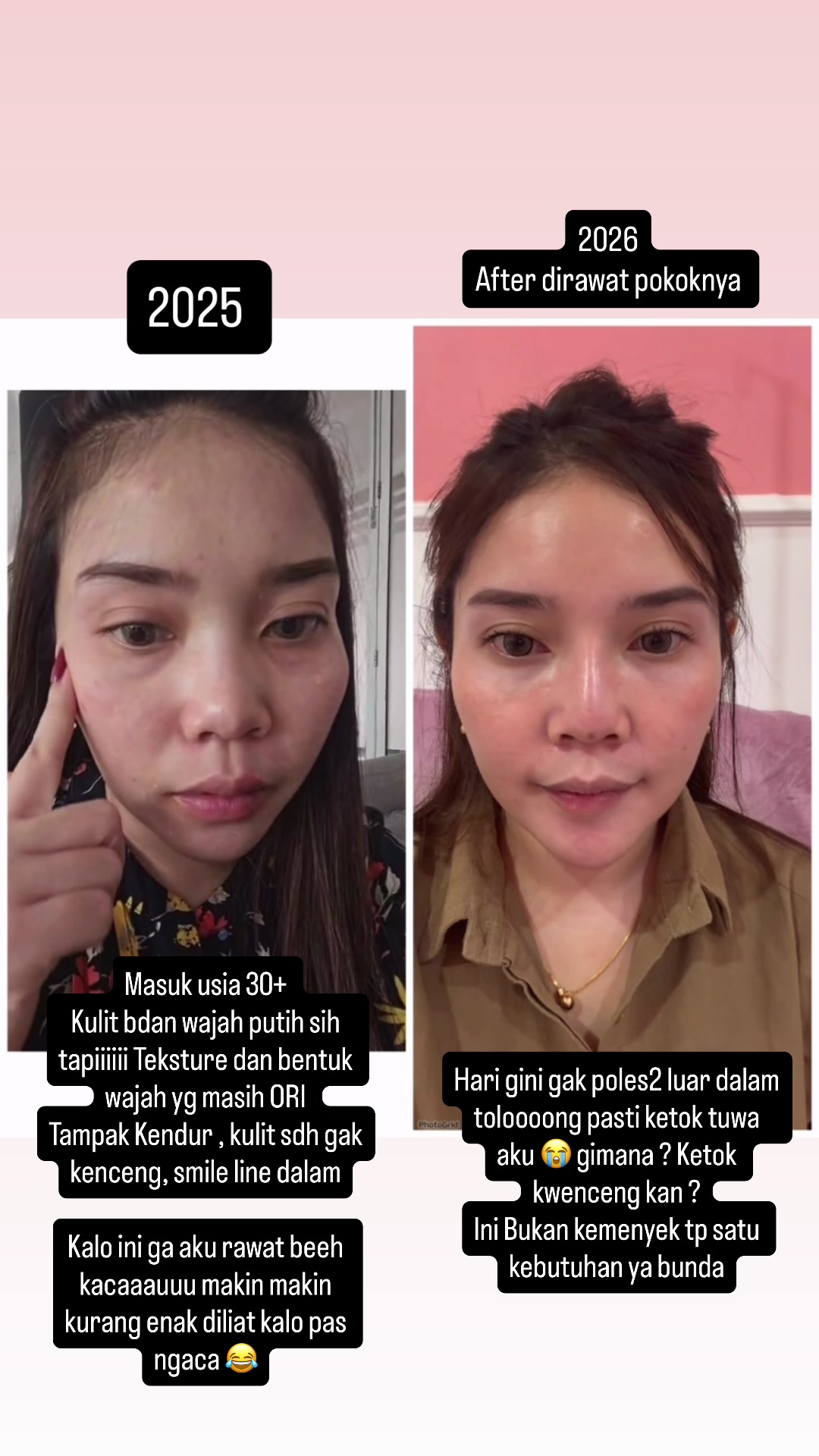 @Hainon Infus Whitening