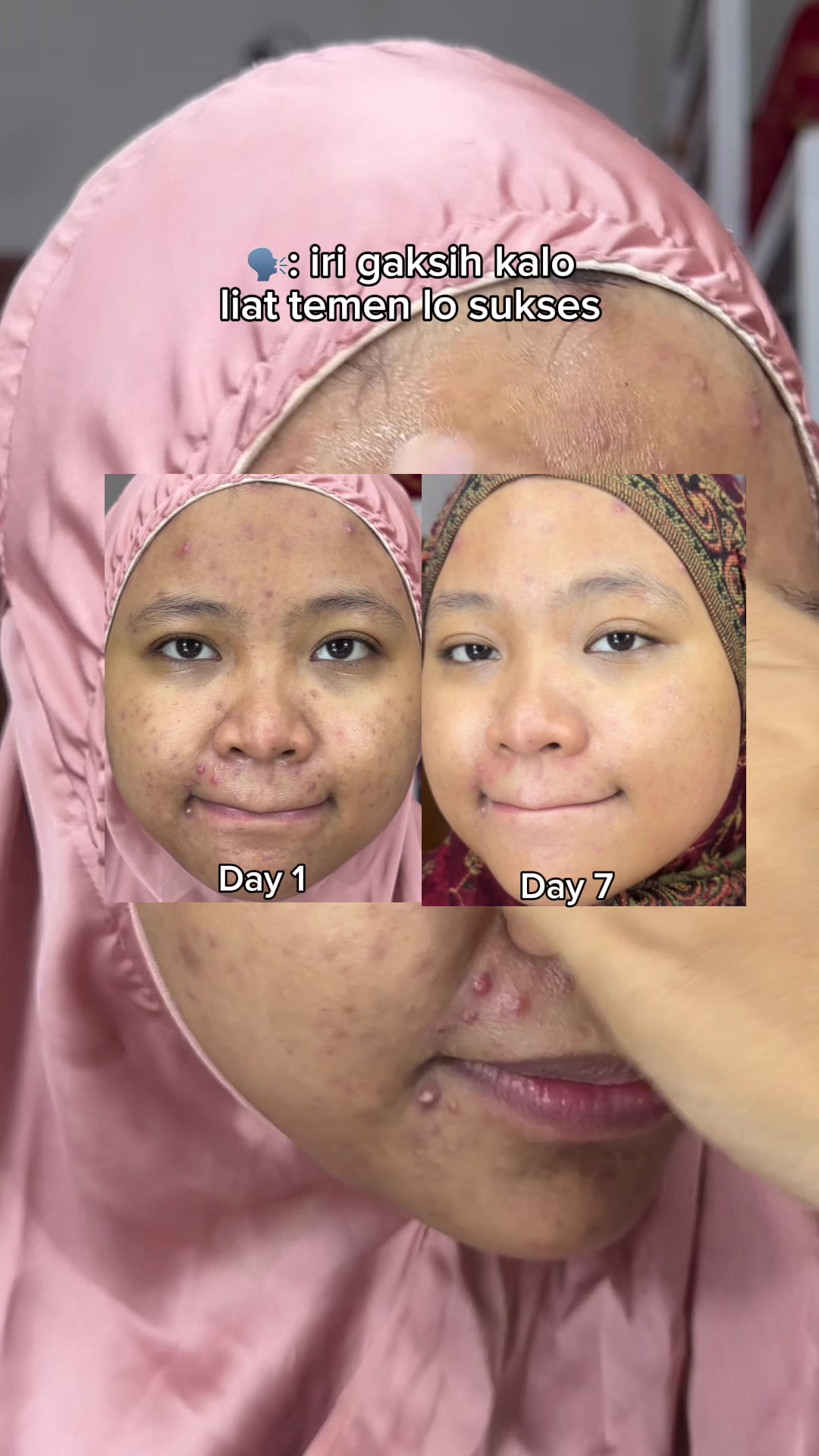@MBAK CUNGCAT BAYI