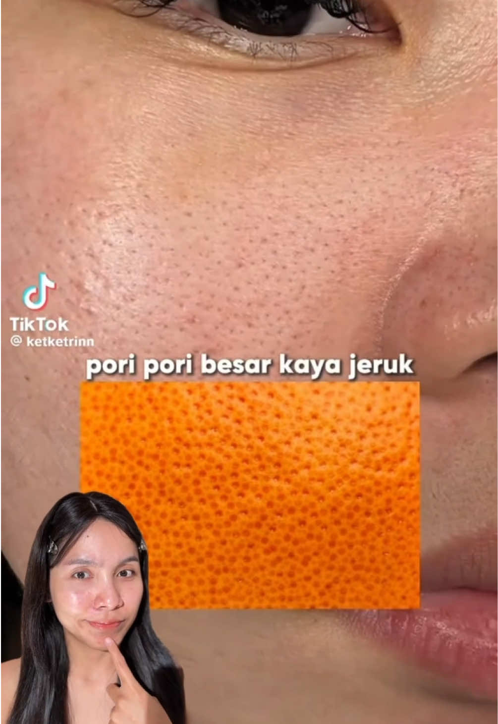 @Deenish_