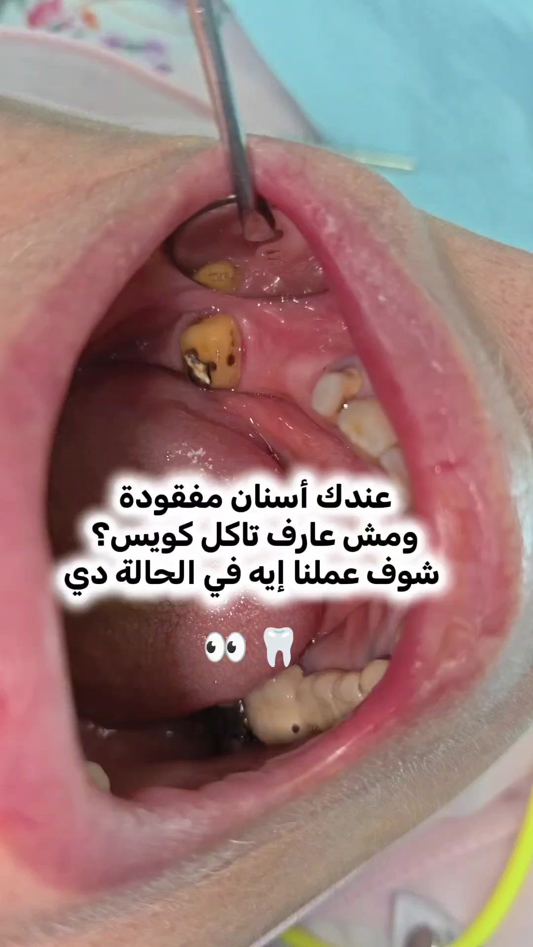 @Dr Ahmed Fattouh