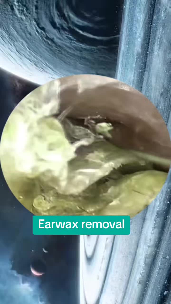 @Earwax.pro