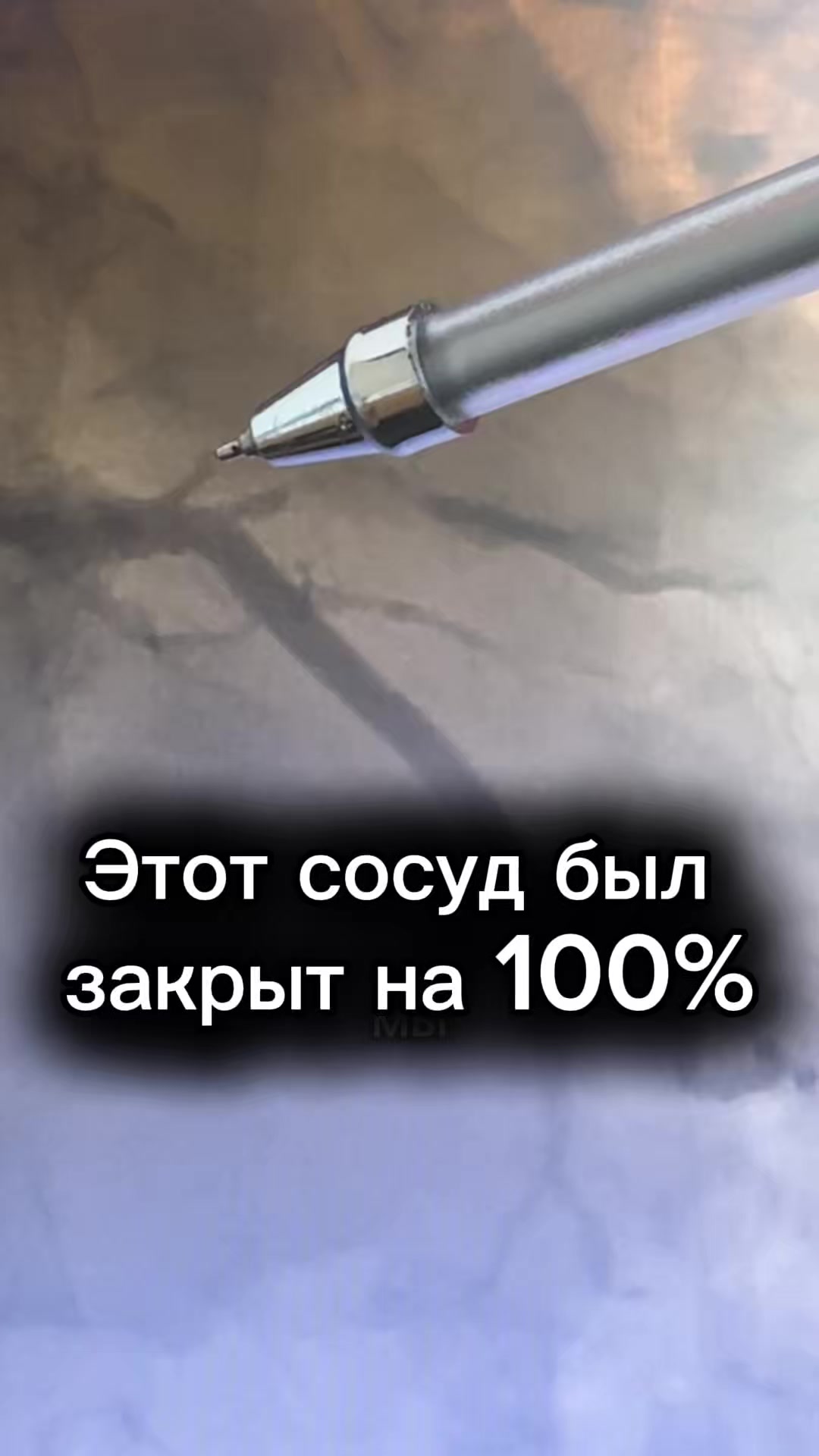 @Кардиолог / Аспет