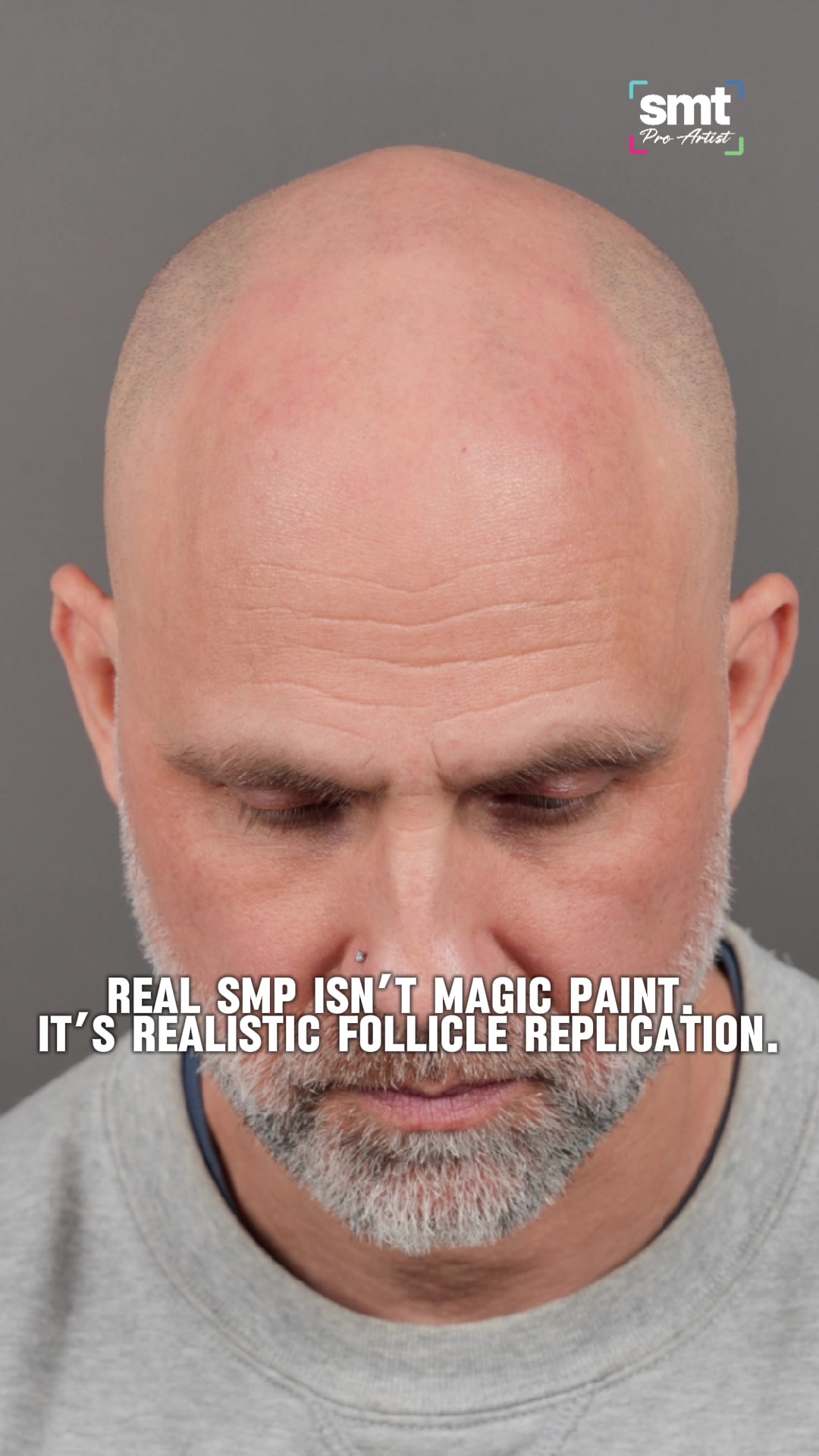 @Enhanced Scalp