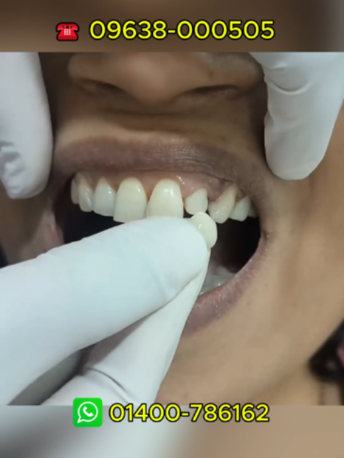 @Tech Dental