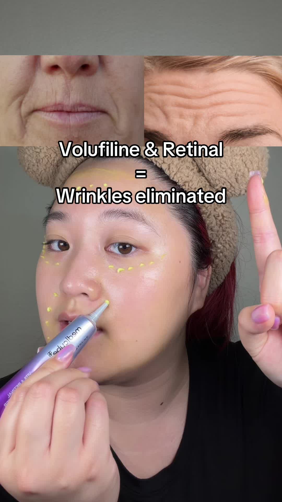 @Korean Skincare | Trish Trinh