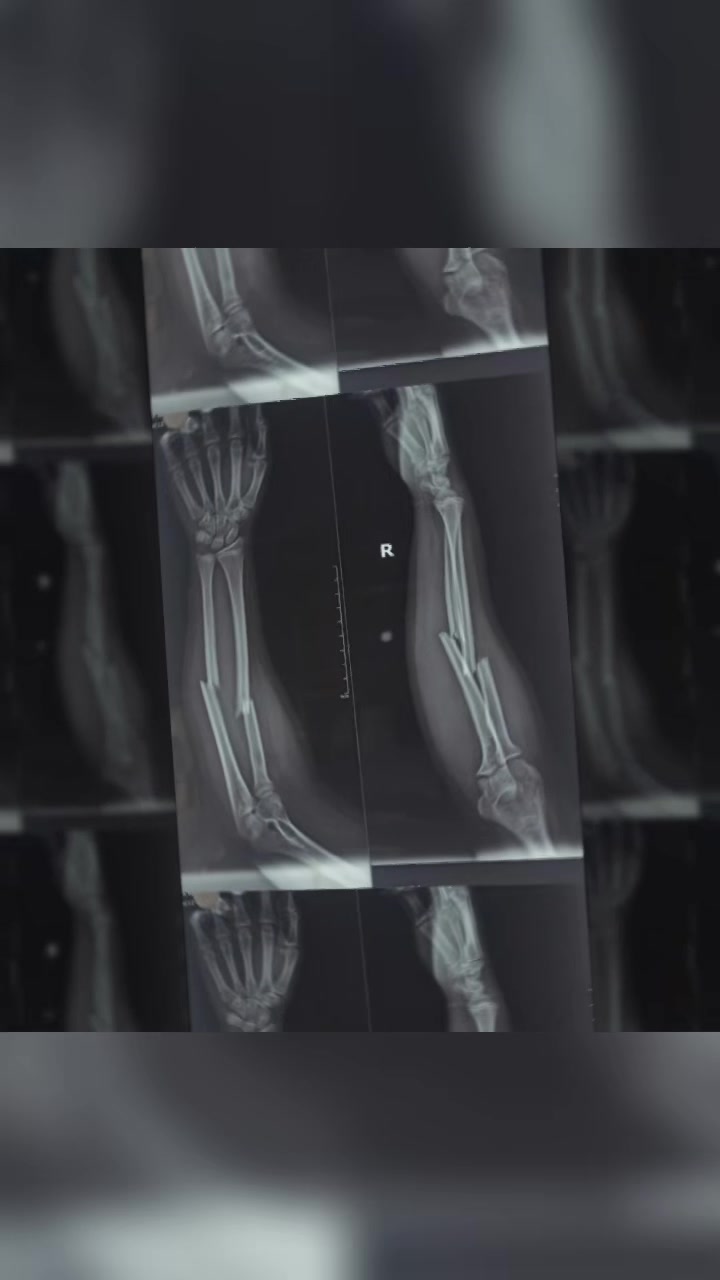 @Dr.Sanjay Gautam,Orthopedics🦴