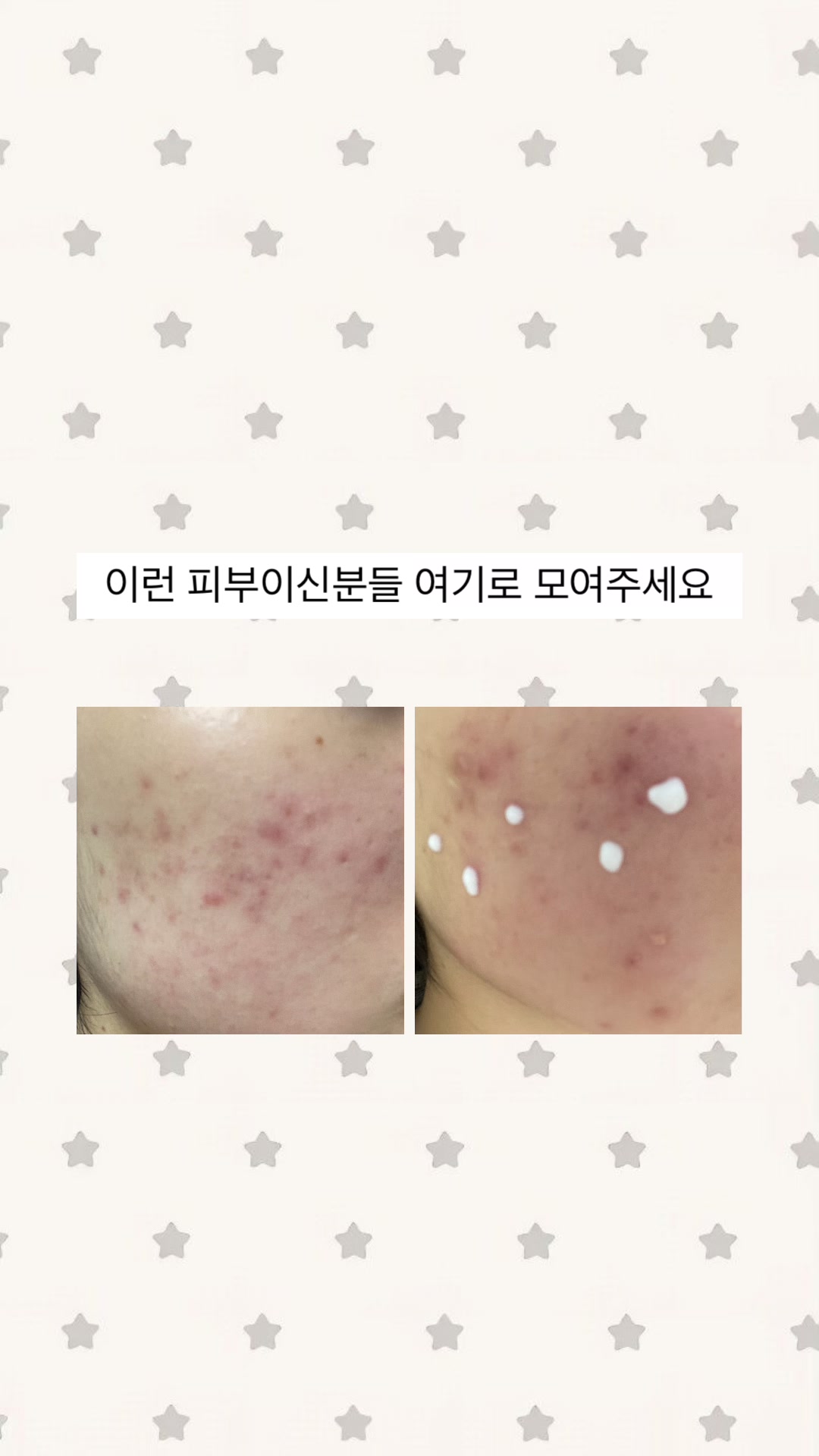 @흐규