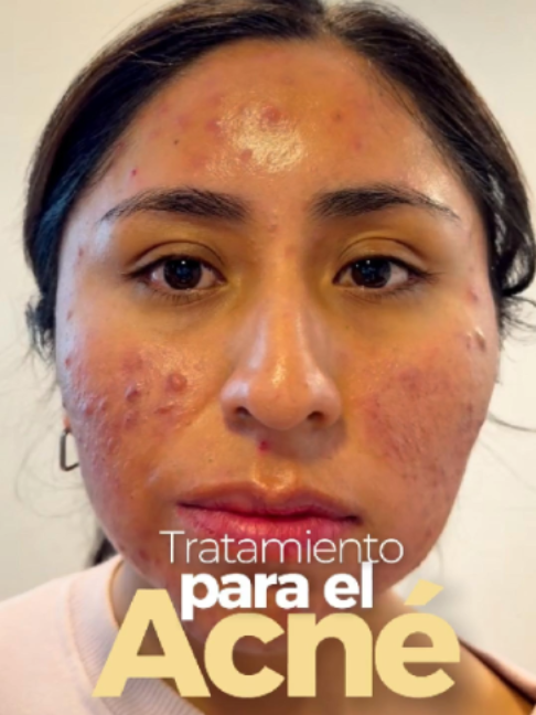 @RebellSpa