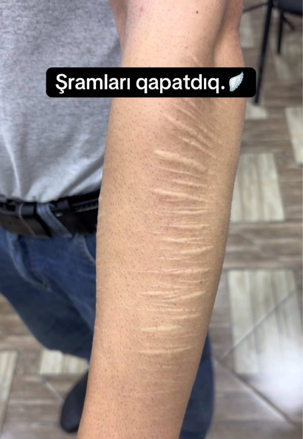 @TattooSamir Yevlax