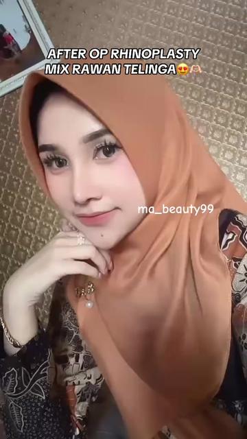 @MA BEAUTY 99