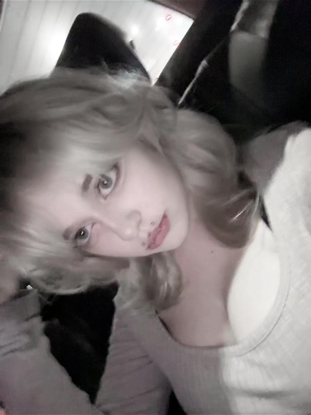 @uglyrosis