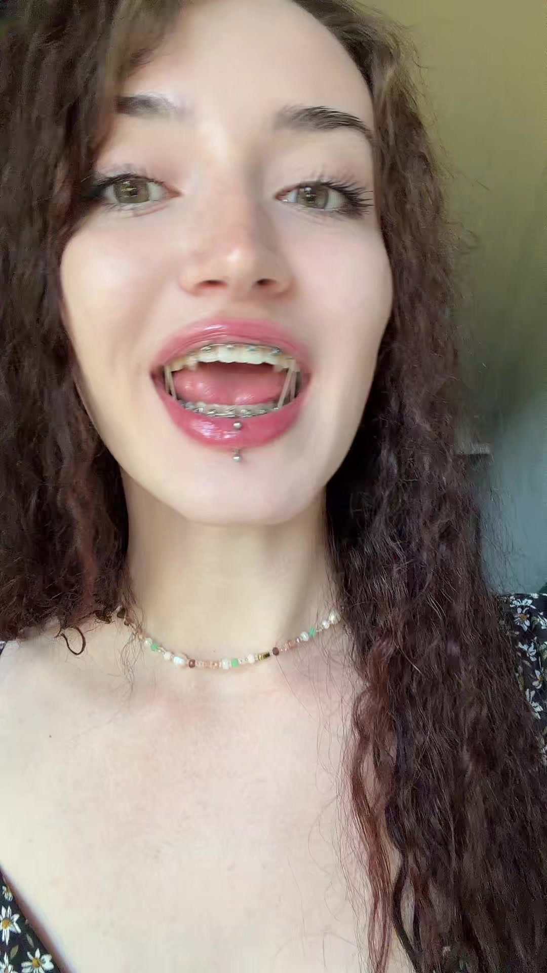 @ssnixsiii