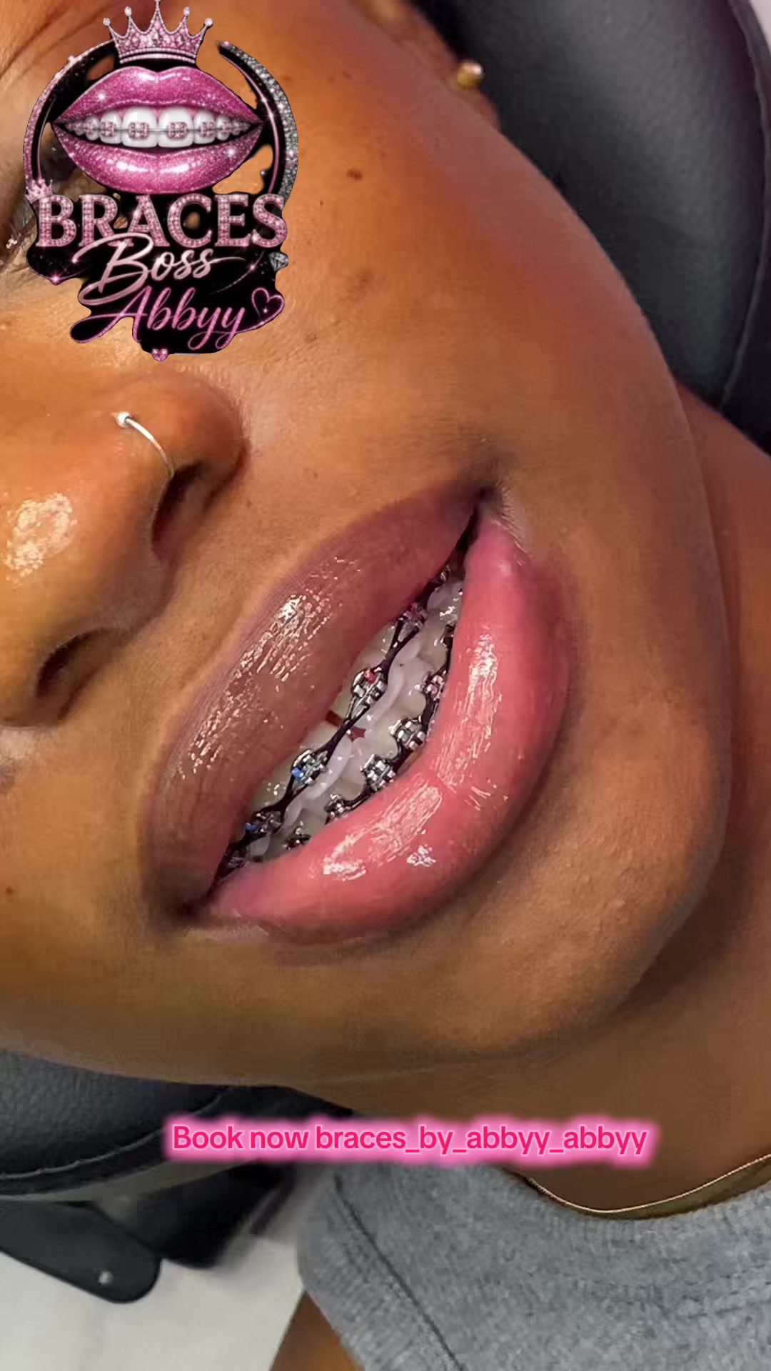 @abbyy_abbyy_
