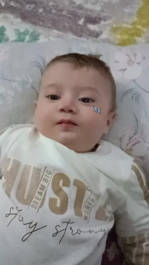 @O_bilay
