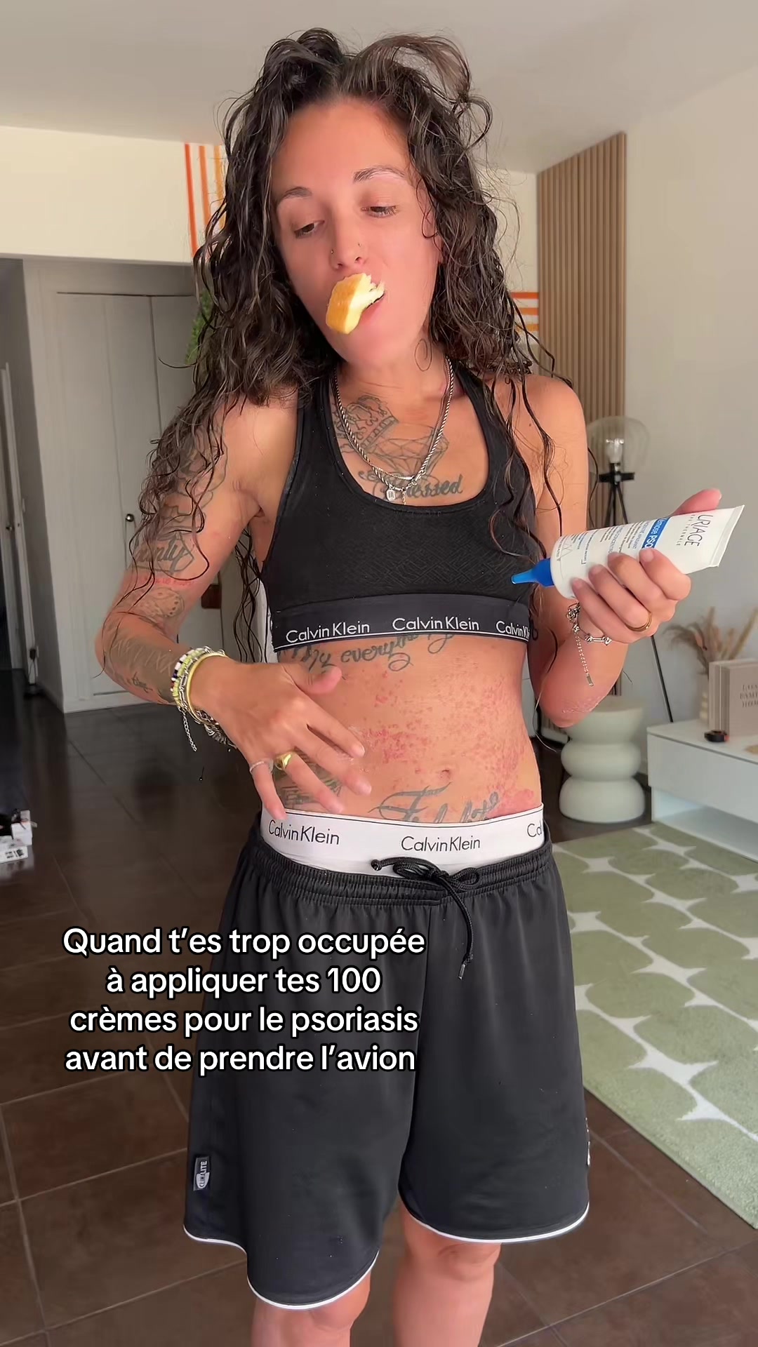 @lyla_psoriasistyle
