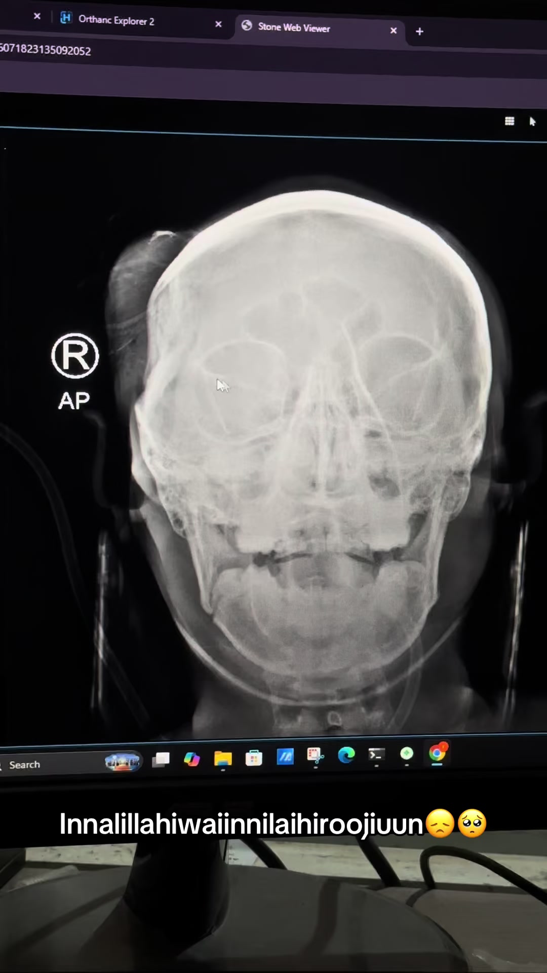 @Sobat Radiology