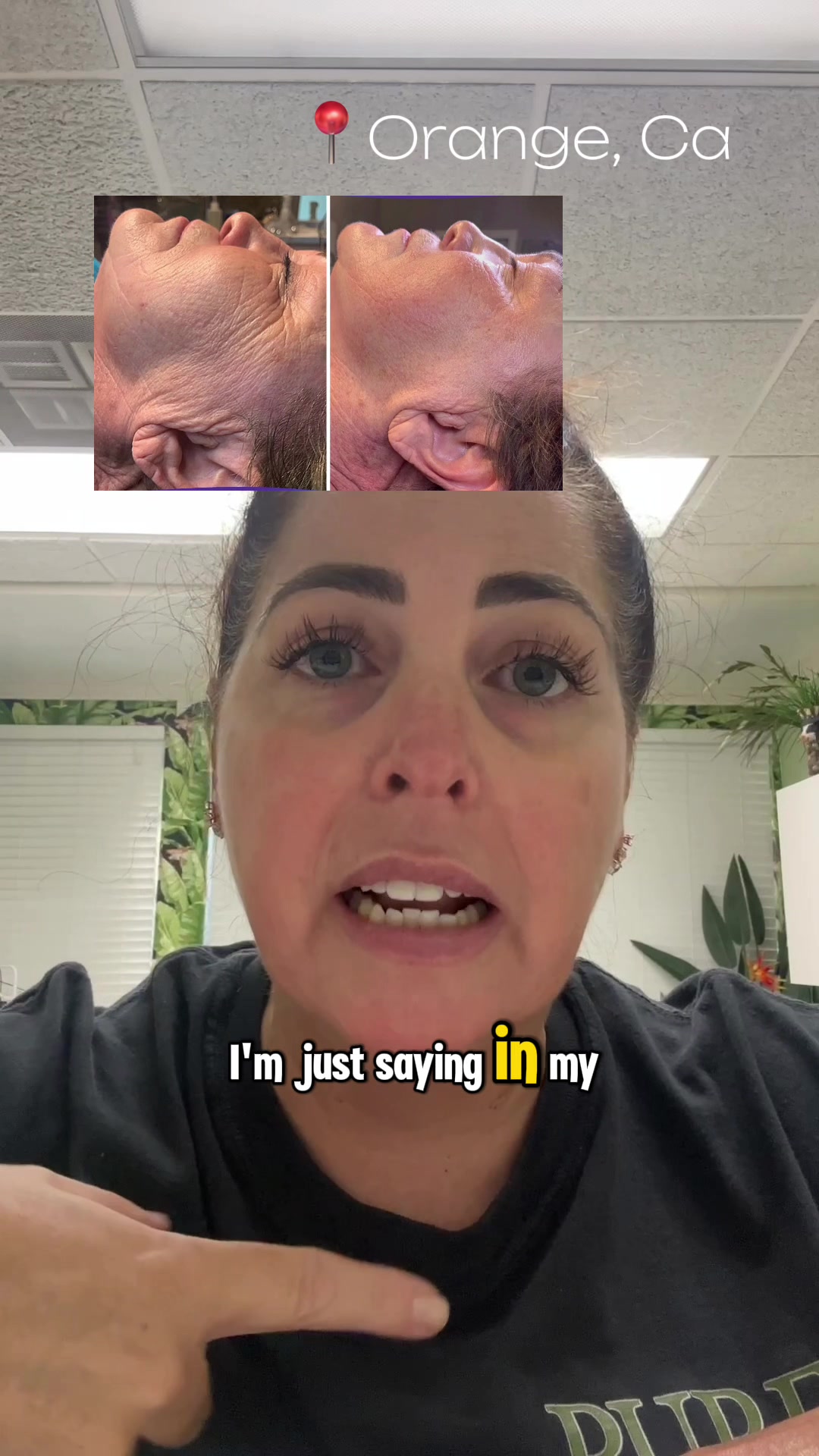 @The OC Esthetician