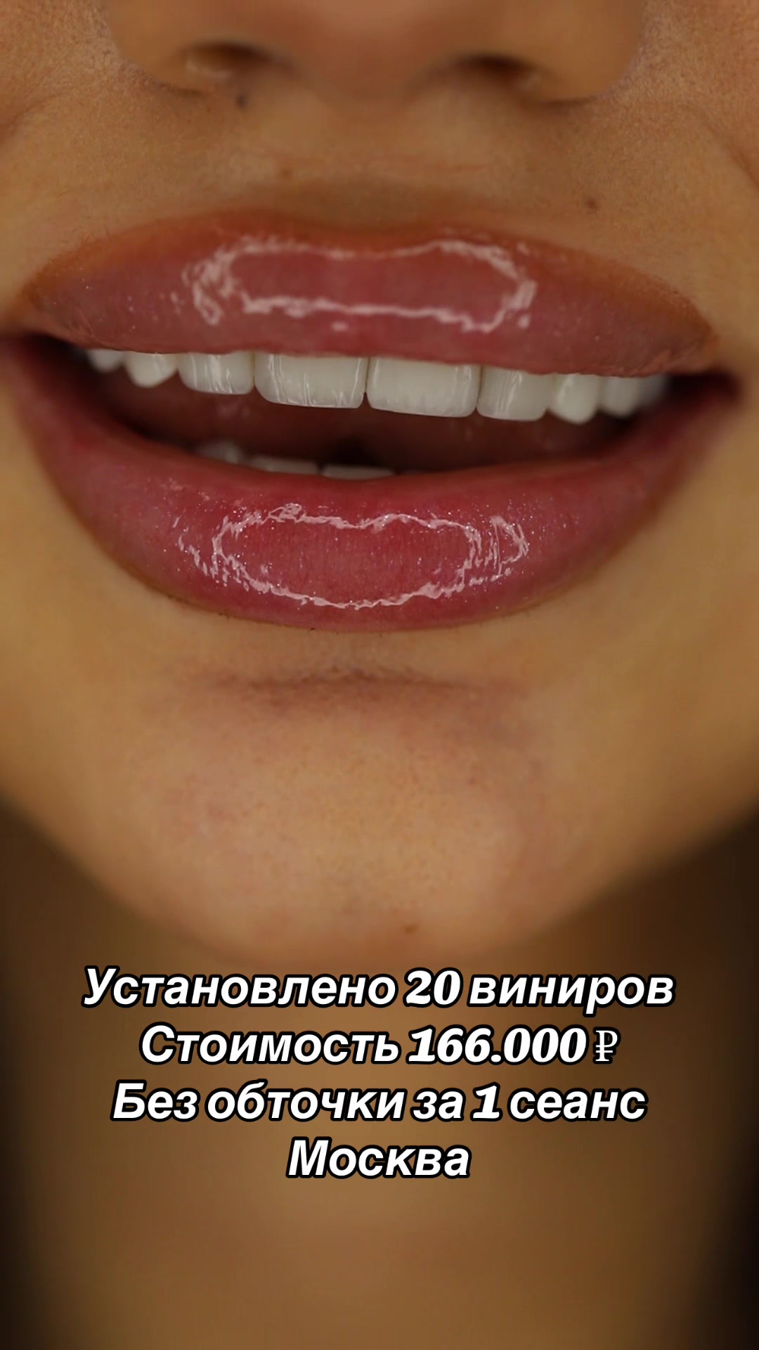 @Royal_smile_moscow