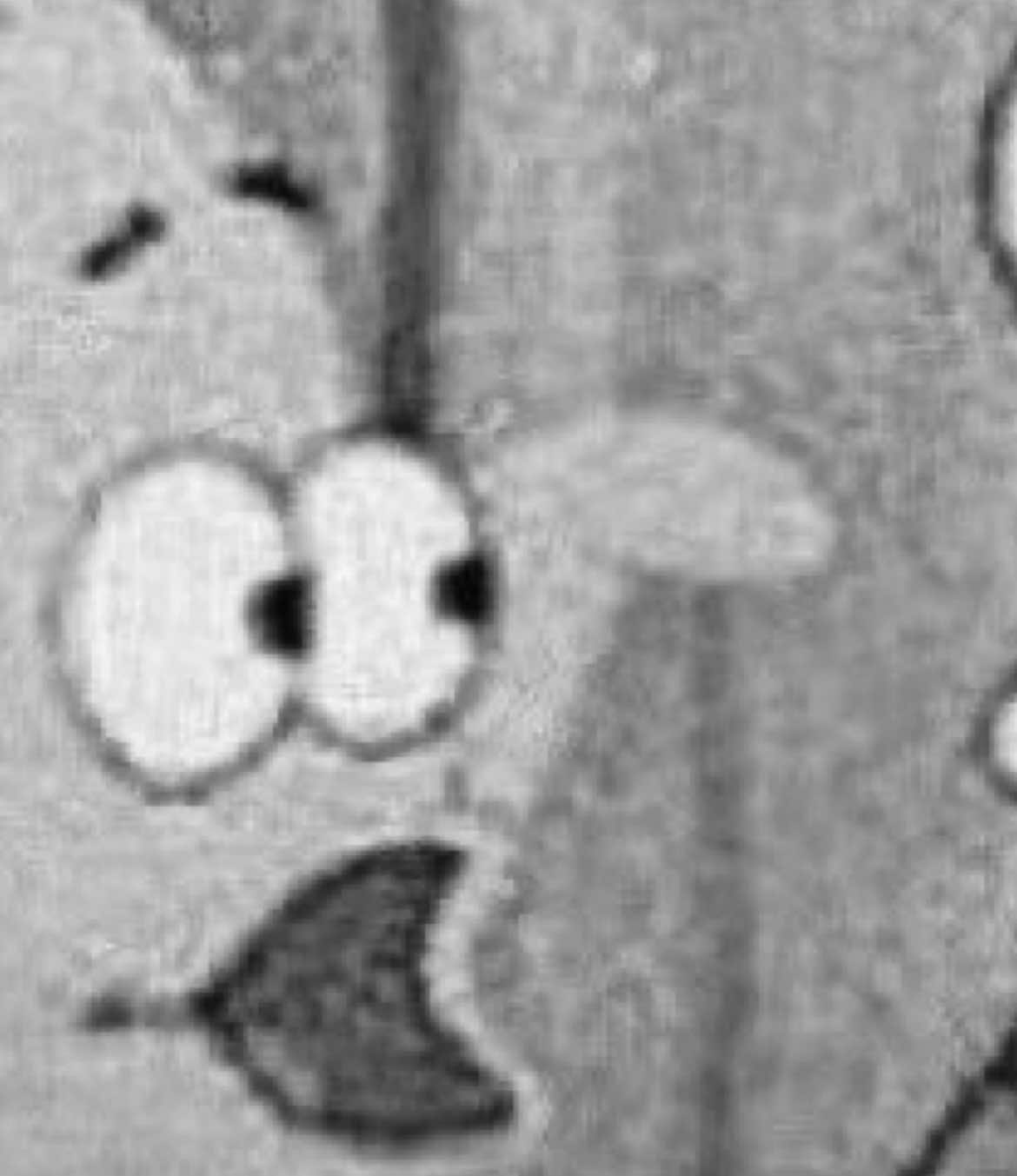 @🩻