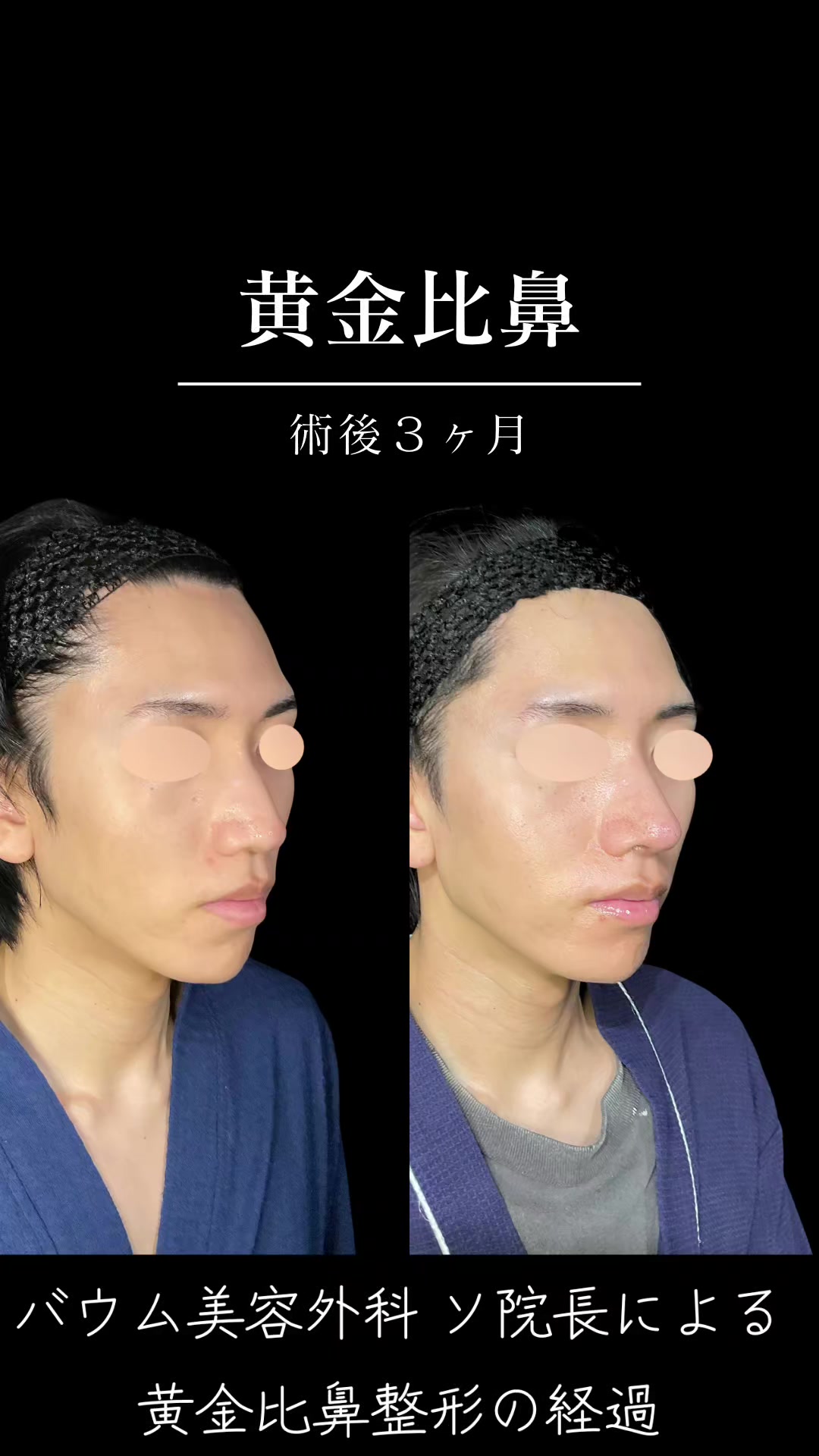 @ソ院長(バウム美容外科/トータル整形)