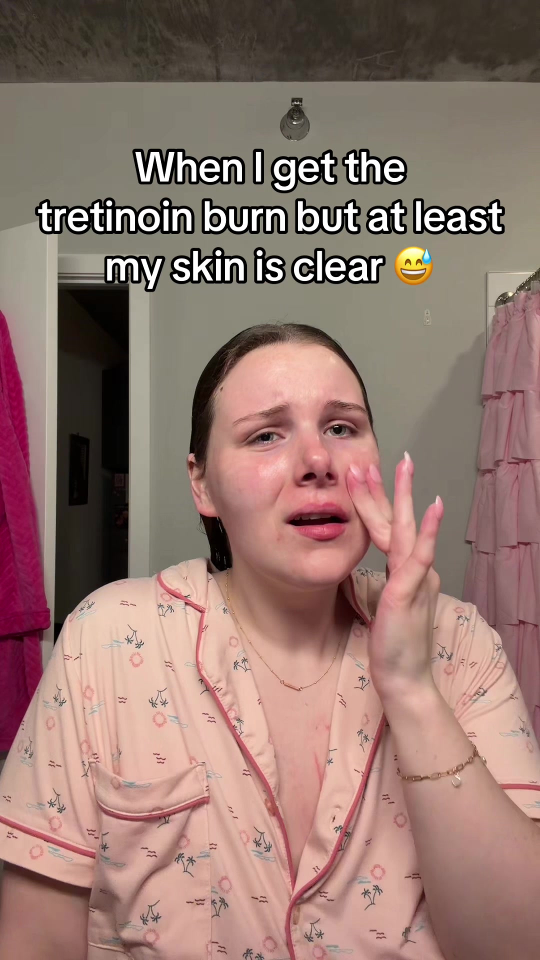 @Kaleigh