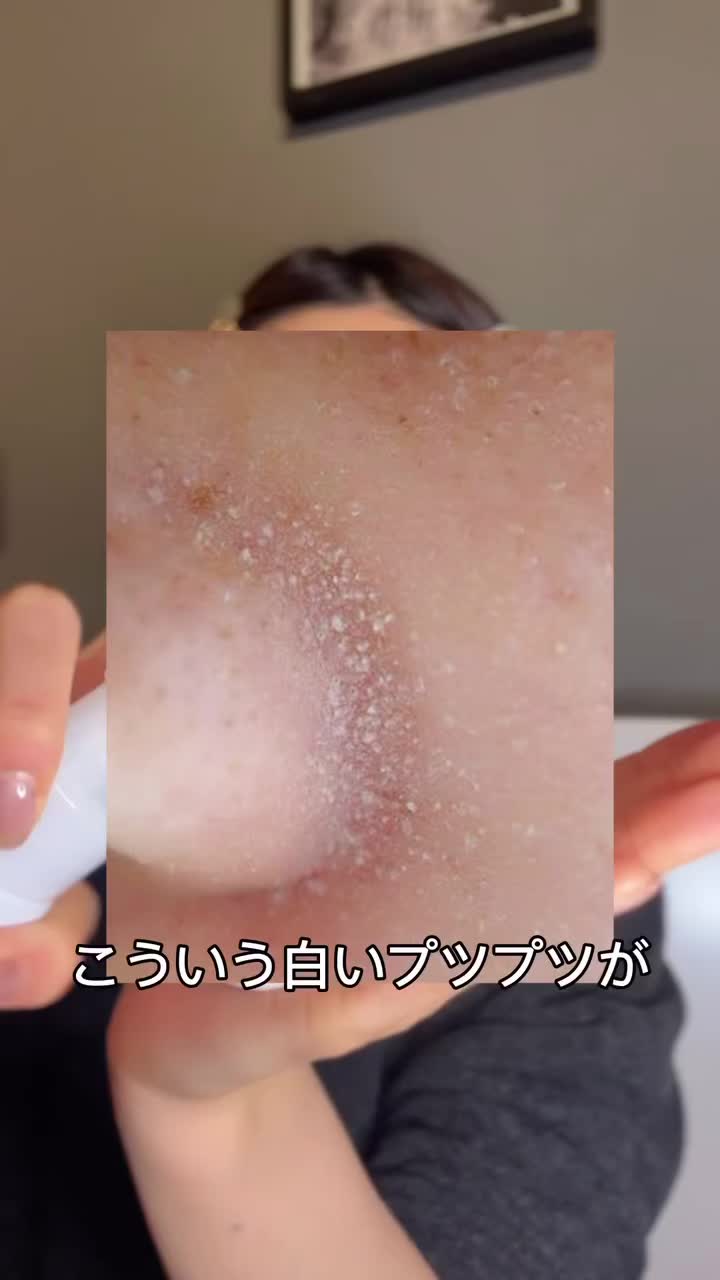 @ニキビ肌から艶肌へ🤍 ari sa