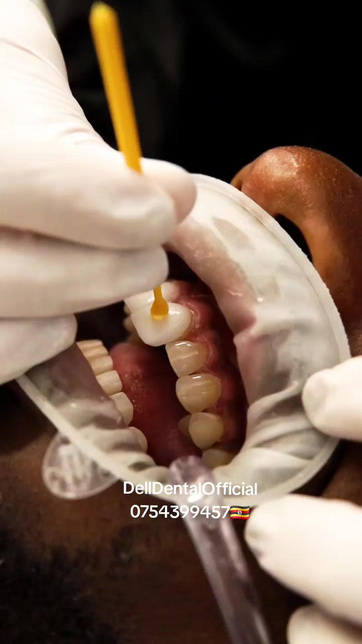 @DellDentalOfficial