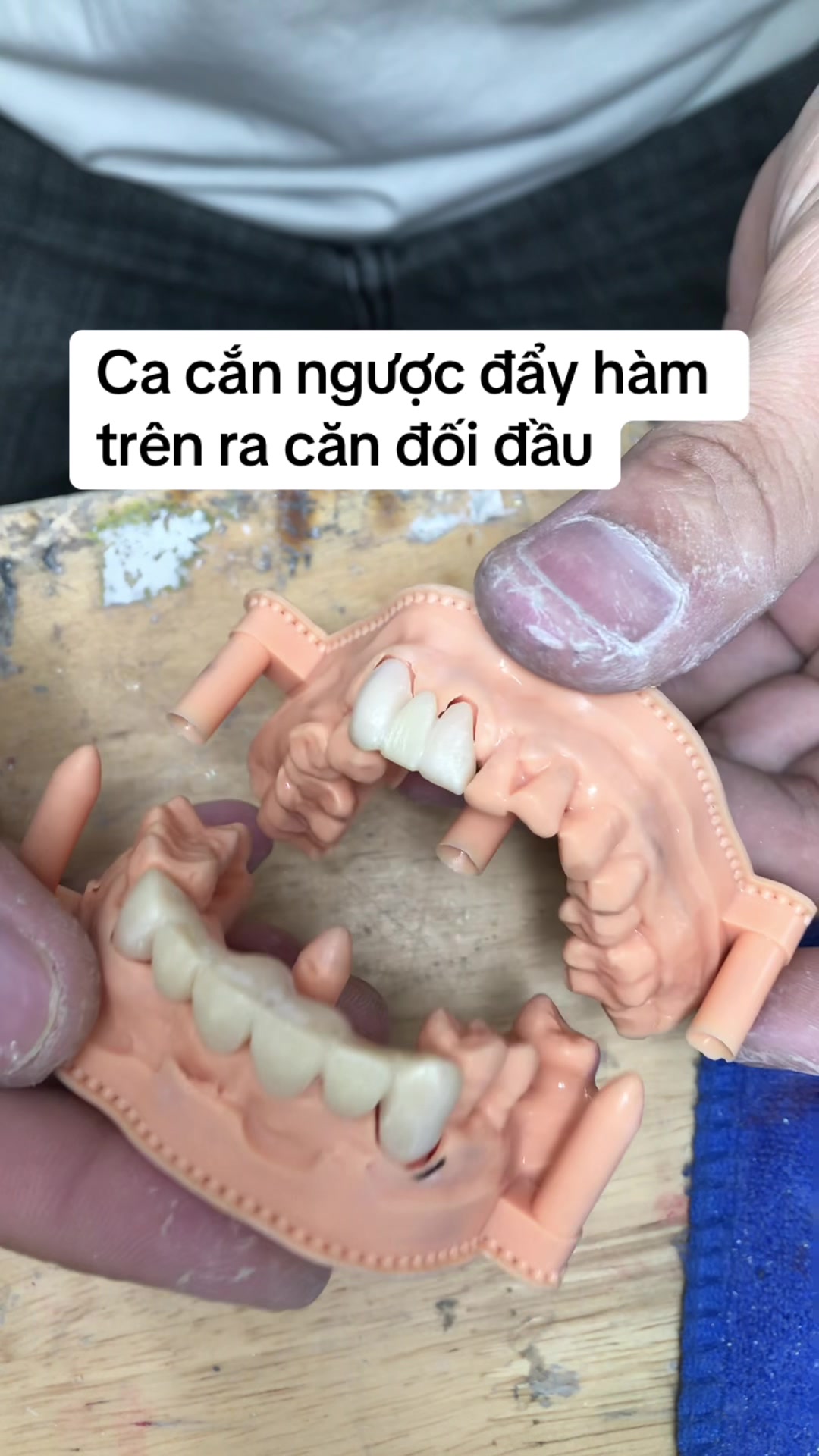@Hùng răng sứ 🦷🦷
