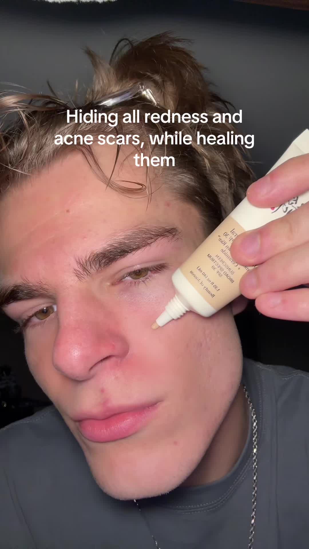 @Finn