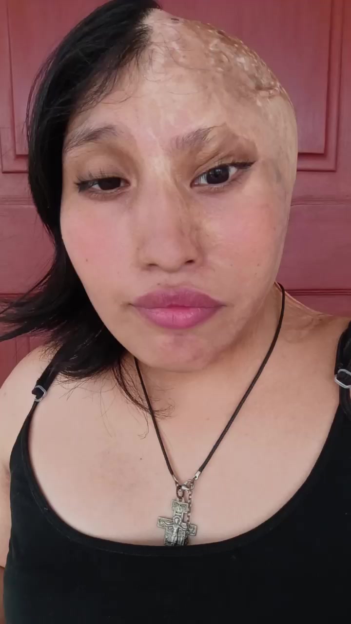 @Elizabeth Carri&oacute;n