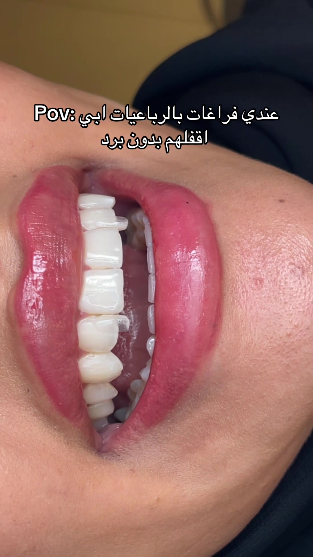 @Dr. Abrar Alhababi