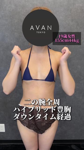 @森脇進/二の腕脂肪吸引・豊胸/AVAN TOKYO