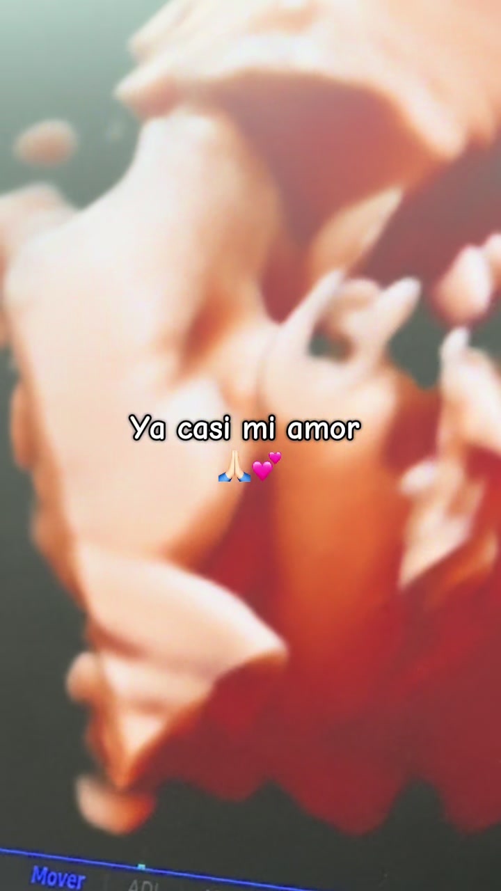 @Irene Castillo