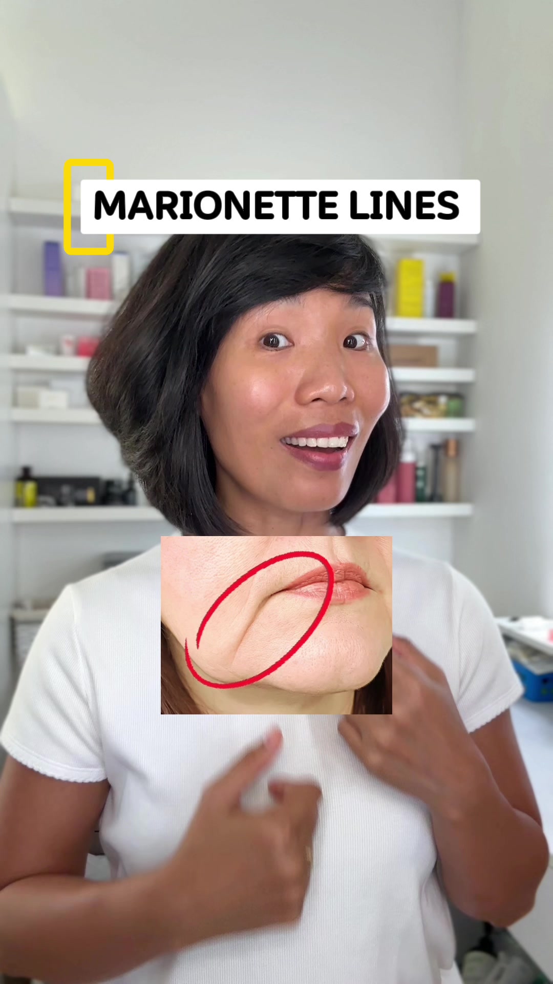 @Trinh Georg