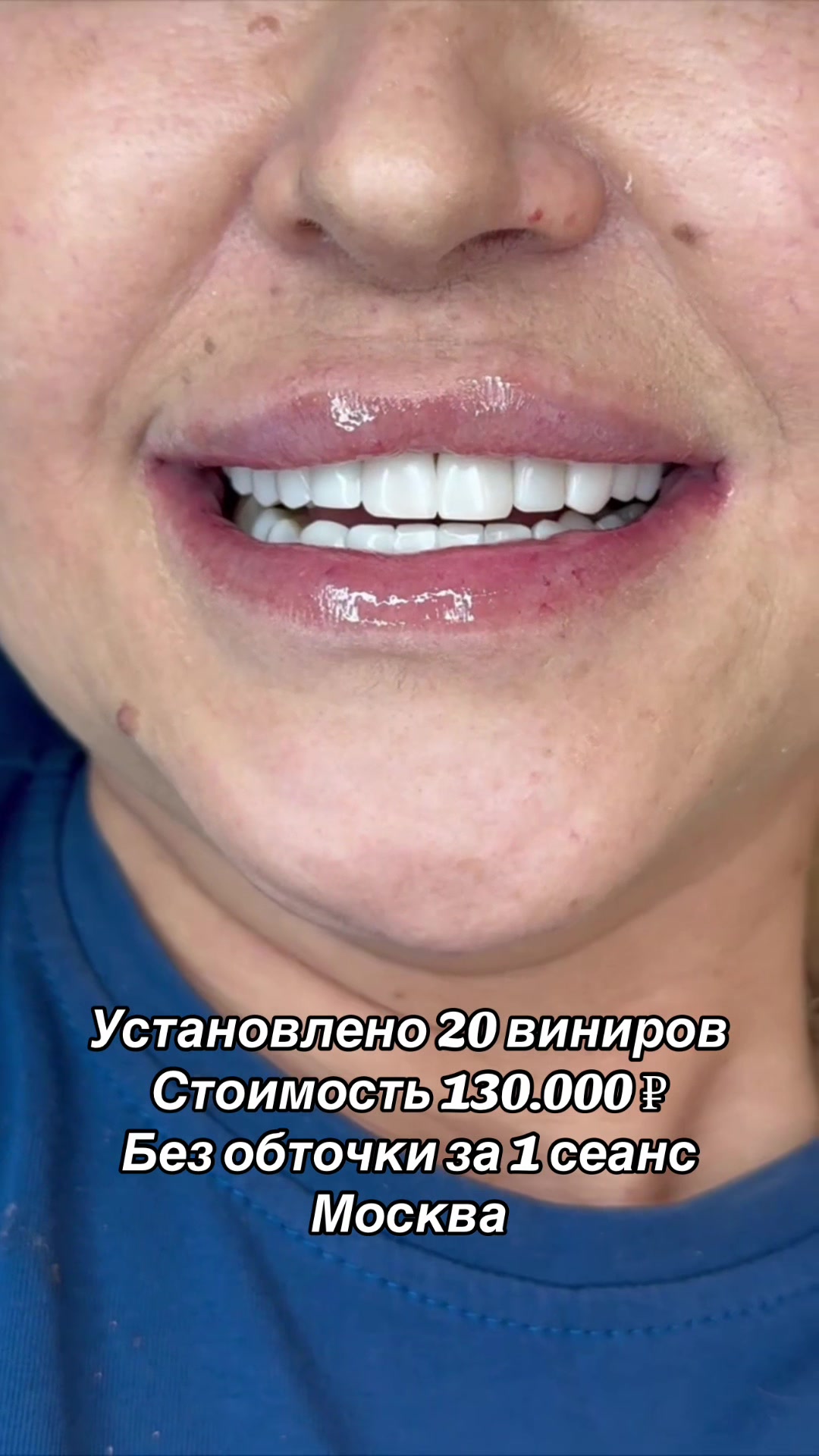 @Royal_smile_moscow
