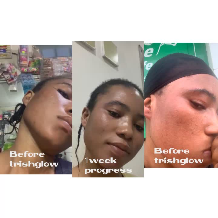 @Trishglow