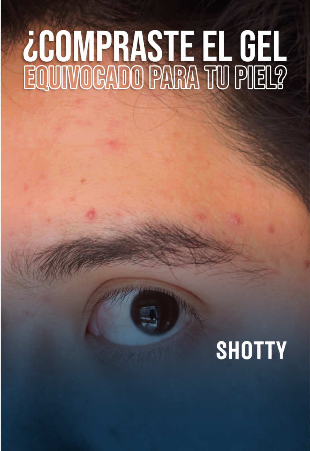 @Shotty