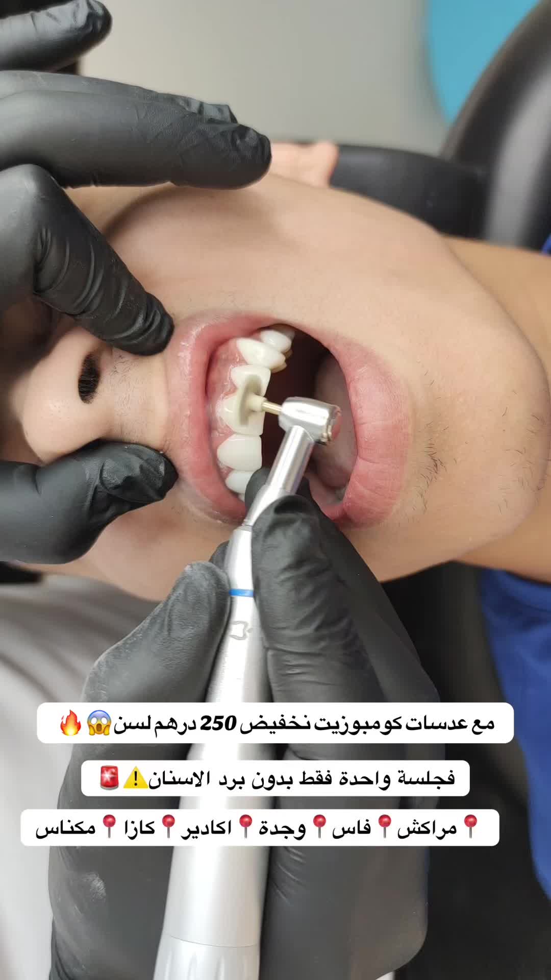 @brightsmileee1