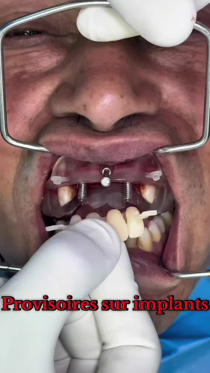 @Dr Nabi-Couture Smile